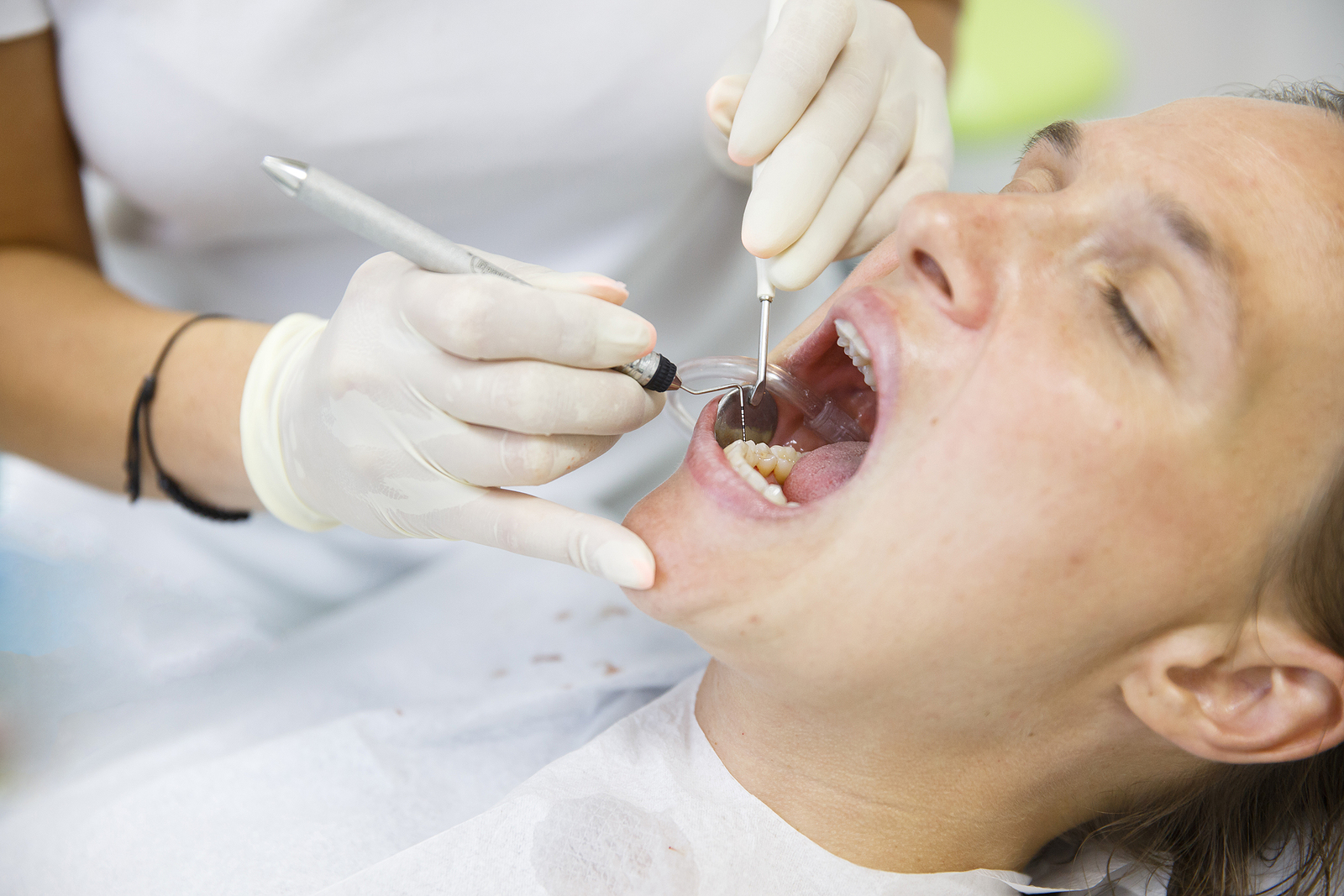 Dental Extractions in Greenville, NC