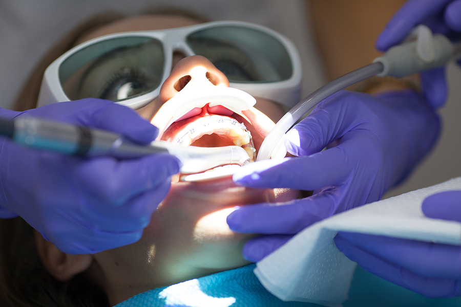 This is a thumbnail image of blog Transforming Smiles with Laser Dentistry in Greenville, NC